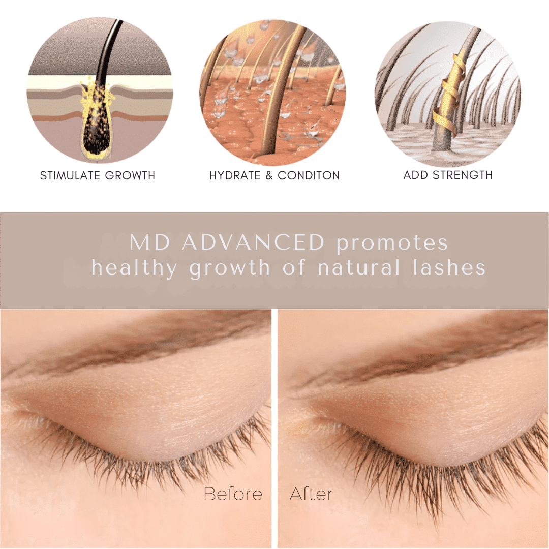 MD Advanced Lash Growth Serum 5.6mL