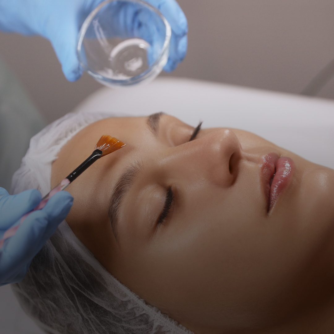 Age Erasing Chemical Peel